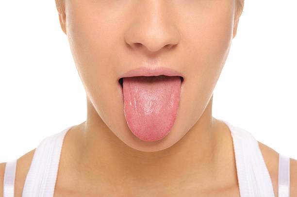 Perbedaan Lidah Normal Dan Tongue Tie
