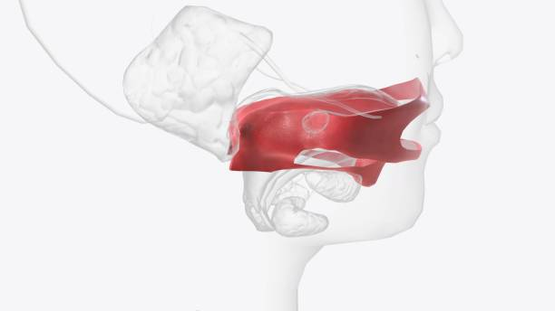 Pengertian Hiponasal